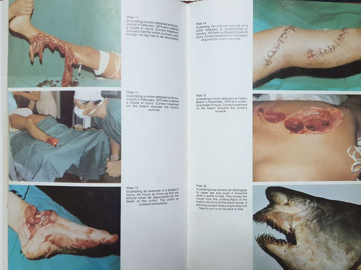 Shark Attack - Tim Wallett (Non-Fiction - Warning, Graphic)