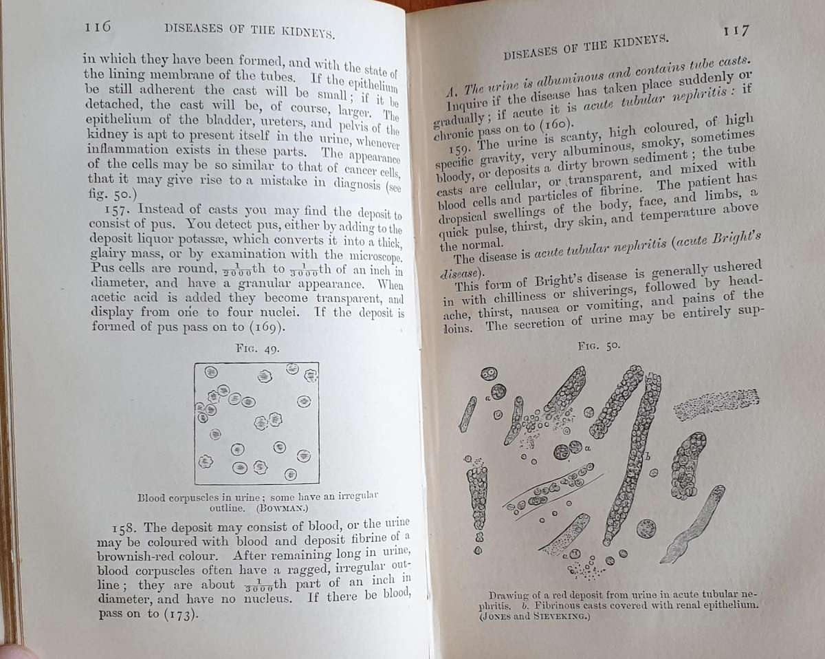 * 1886 * Fenwick's Medical Diagnosis - Samuel Fenwick