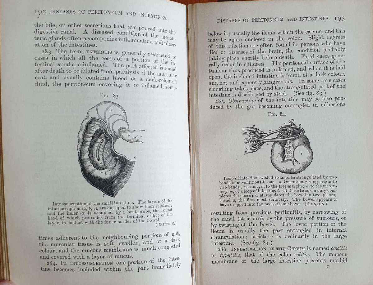 * 1886 * Fenwick's Medical Diagnosis - Samuel Fenwick