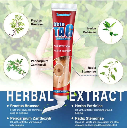Skin tags removal Cream