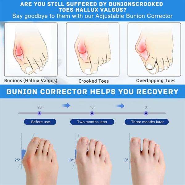 Effective and Discreet Toe Corrector & Bunion Pain Relief Socks