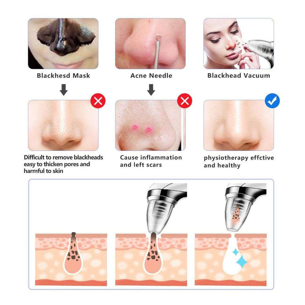 Blackhead Remover Pore Vacuum with 6 Sucker Heads & 3 Suction Modes