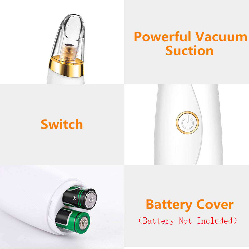 Blackhead Remover Pore Vacuum Cleaner with Three Sucker Heads