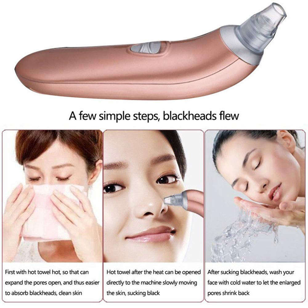 Blackhead Remover Pore Vacuum Cleaner with 4 Sucker Heads - Rose Gold