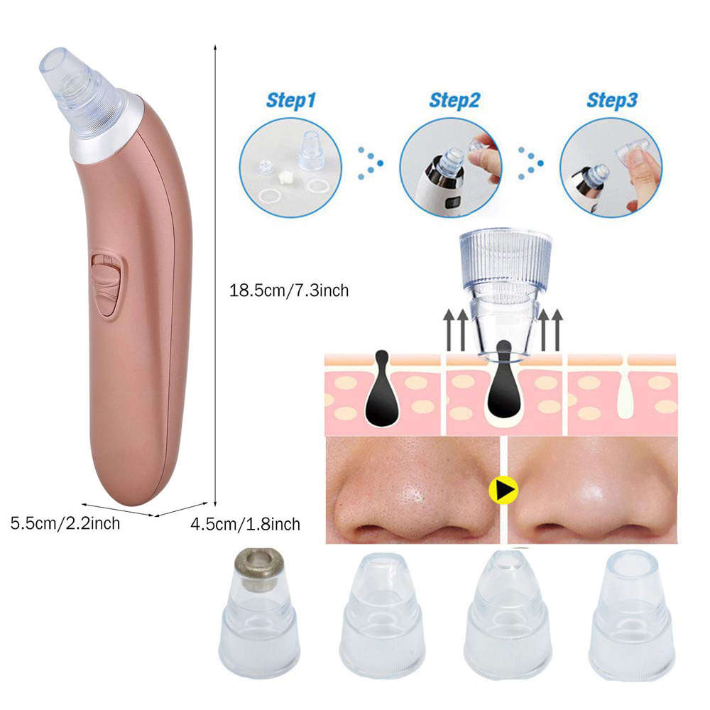 Blackhead Remover Pore Vacuum Cleaner with 4 Sucker Heads - Rose Gold
