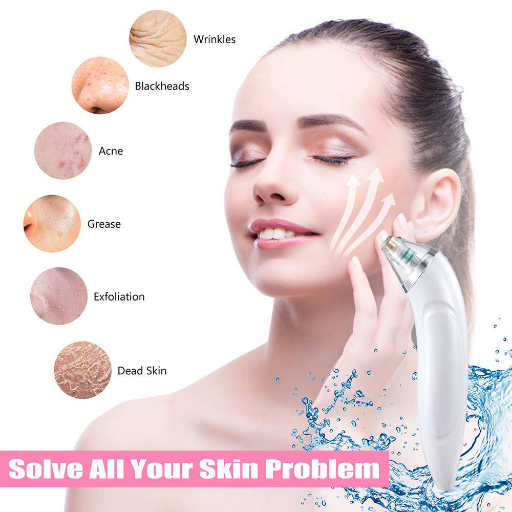 3 Levels Electronic Blackhead Remover Vacuum Cleaner with 4 Probe-White