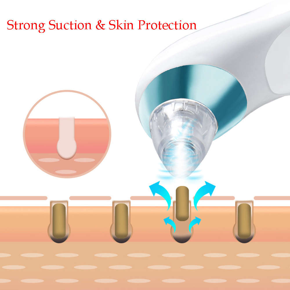 Electronic Blackhead Remover Vacuum Cleaner with 4 Probe - Blue