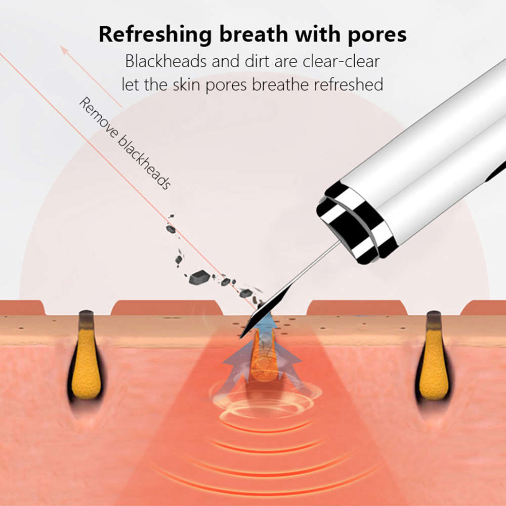 Ultrasonic Skin Scrubber Deep Face Cleaning Machine Peeling Shovel - White