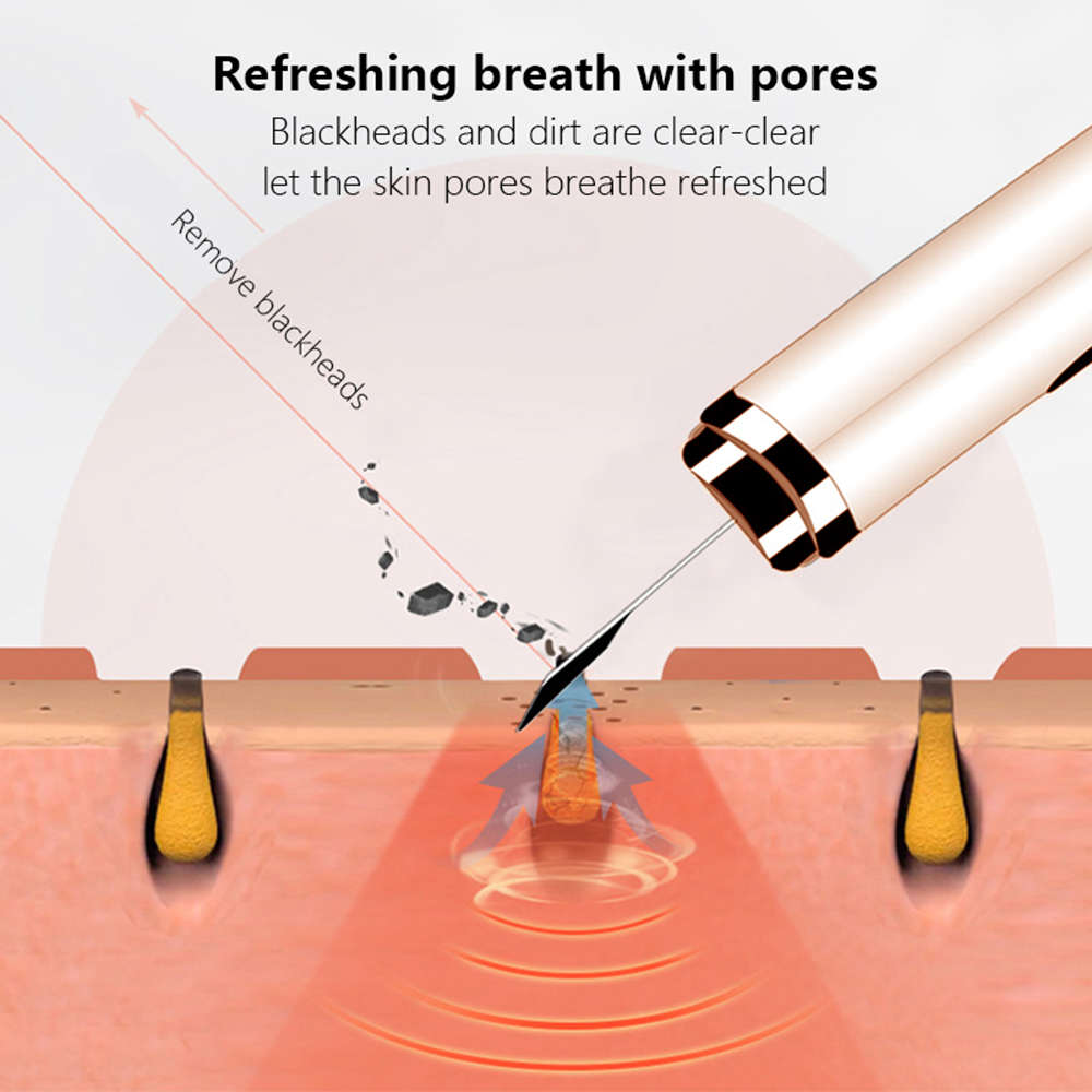 Ultrasonic Skin Scrubber Deep Face Cleaning Machine Peeling Shovel