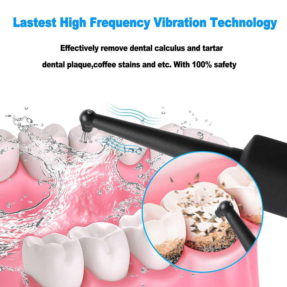 Household Electric Sonic Dental Calculus Remover with LED Light - Black