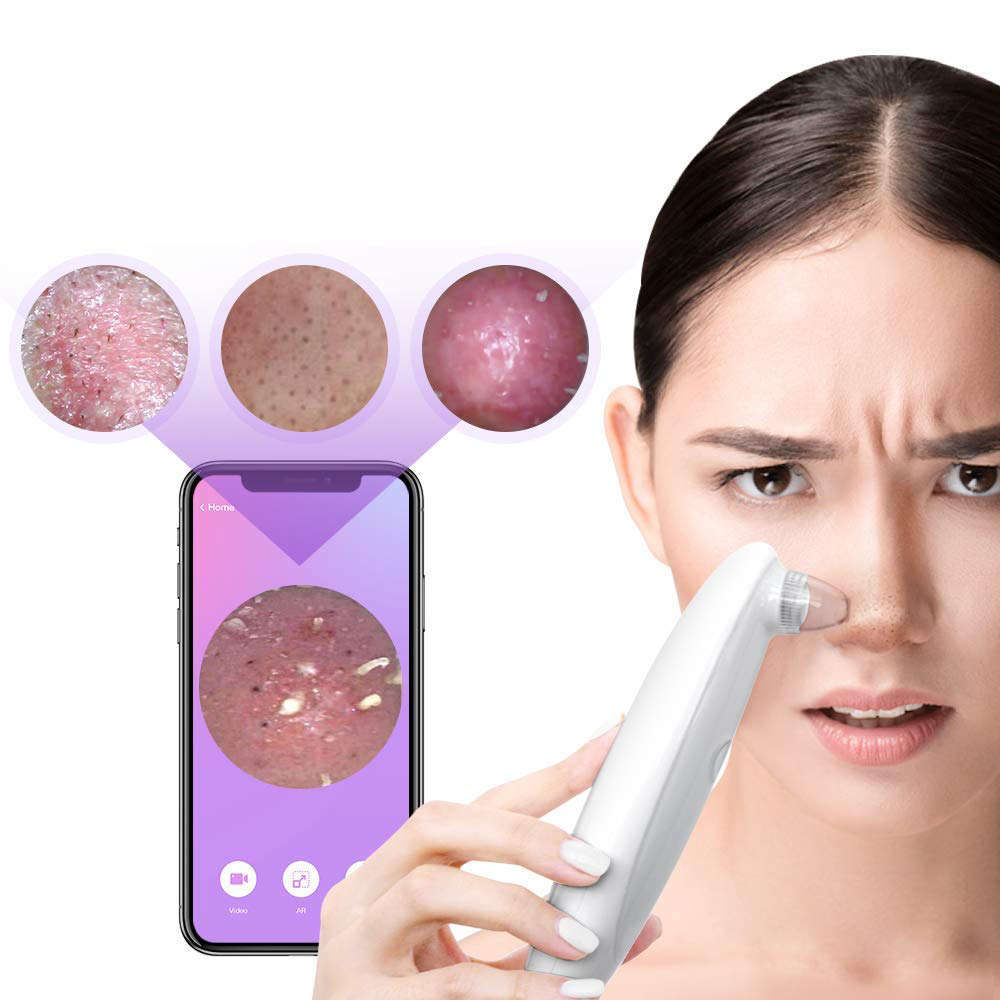 Portable 10X Blackhead Remover Pore Vacuum with HD Camera