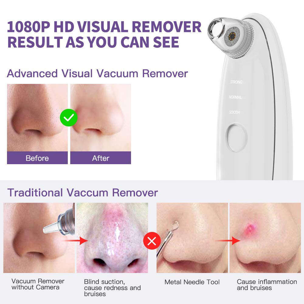 Portable 10X Blackhead Remover Pore Vacuum with HD Camera