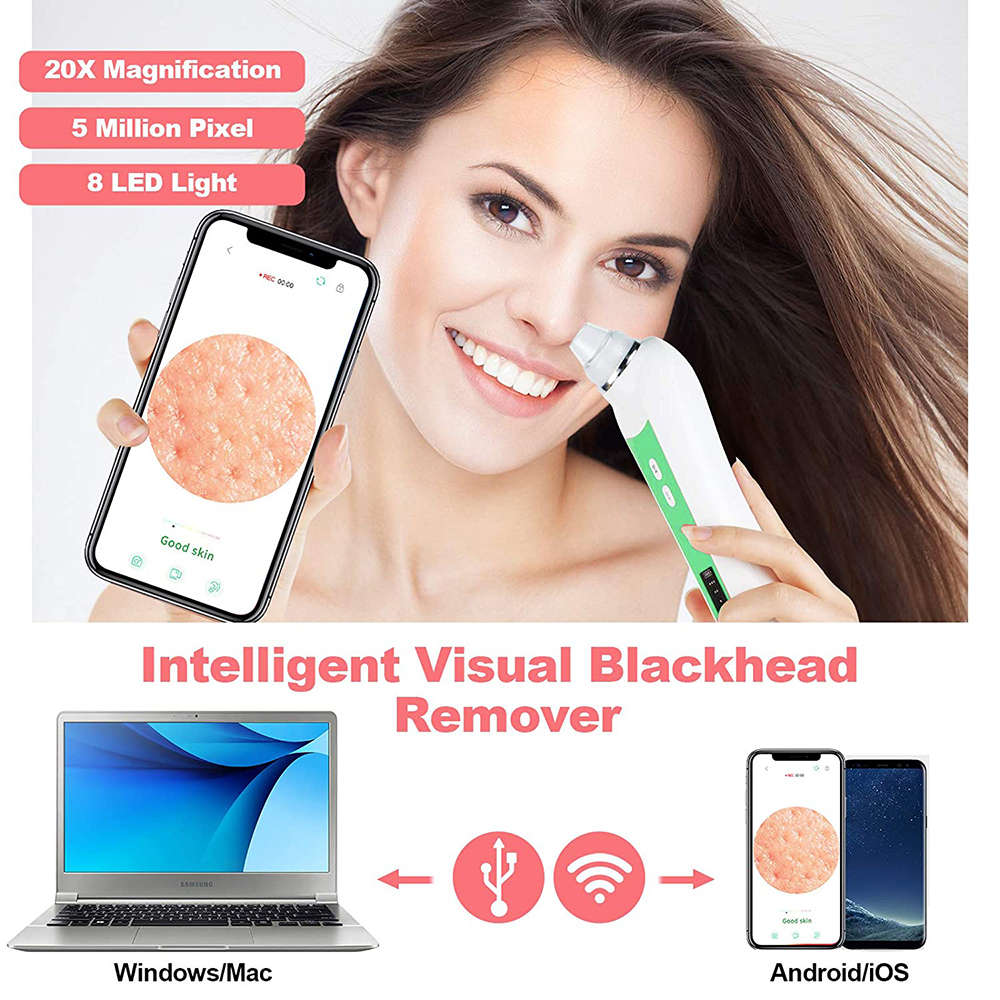 5MP WIFI 20X Magnification Visual Electric Blackhead Remover - Green