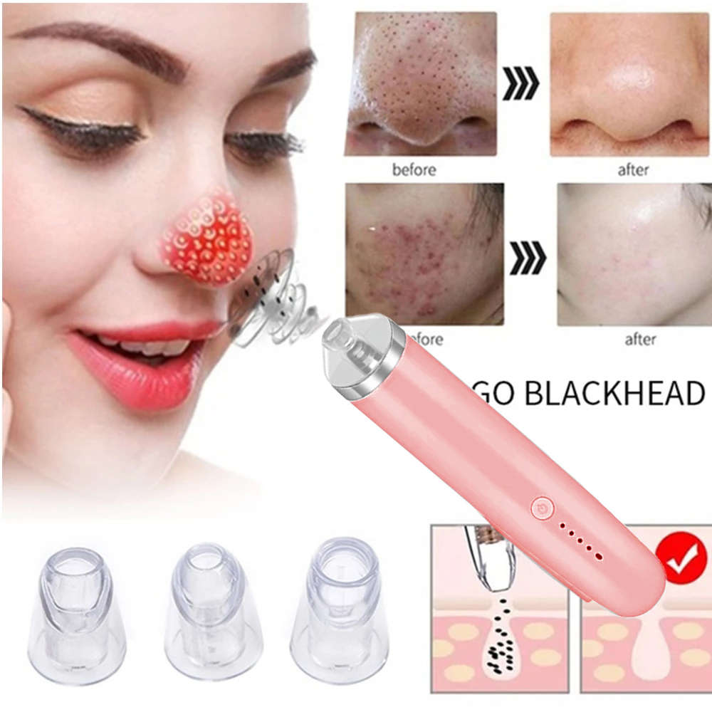 Electric Pore Vacuum Acne Comedone Extractor Kit with 4 Levels - Pink