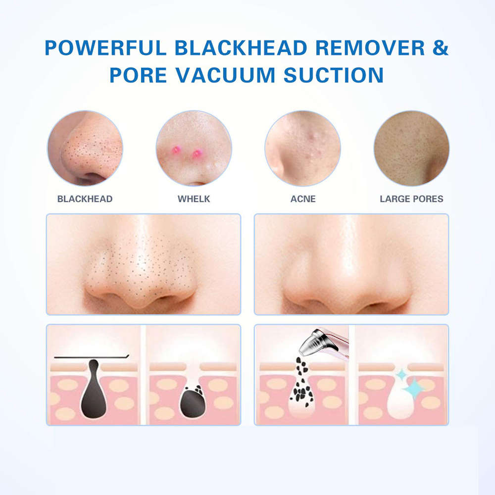 Electric Vacuum Pore Cleaner Blackhead Remover-Rose Gold