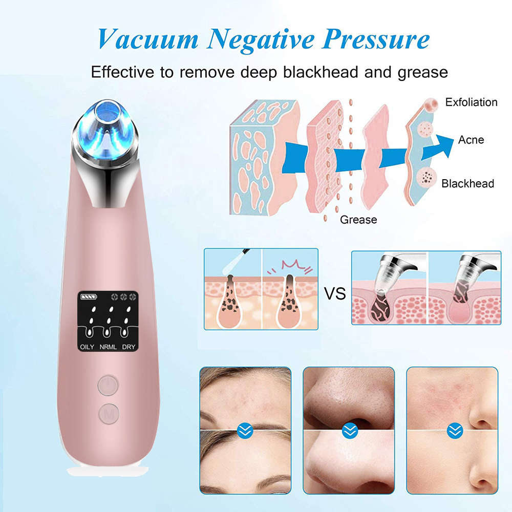 USB Rechargeable Blackhead Remover Vacuum Pore Cleaner-Rose Gold