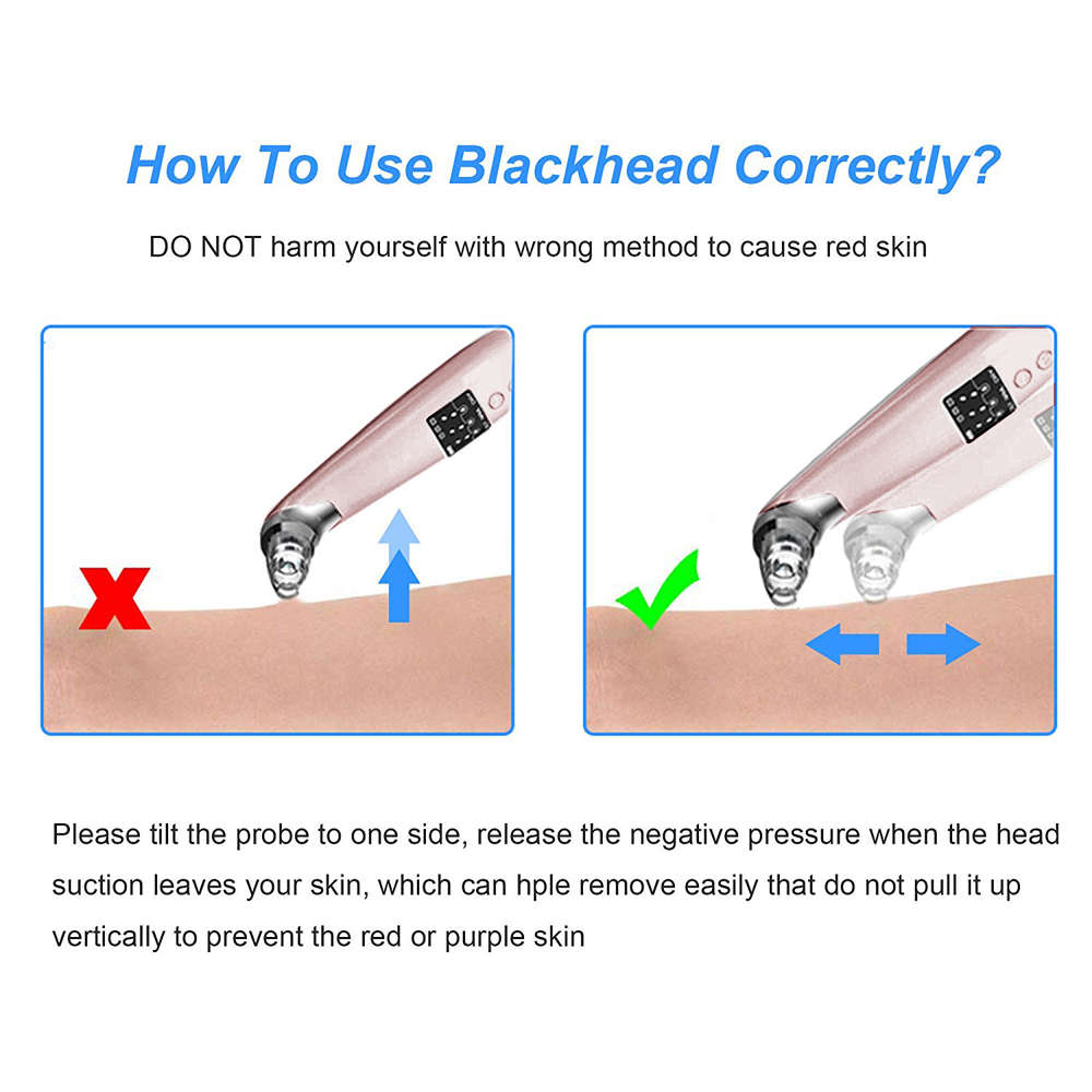 USB Rechargeable Blackhead Remover Vacuum Pore Cleaner-Rose Gold