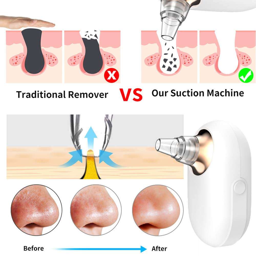 Electric Blackhead Remover Device Vacuum Pore Cleaner
