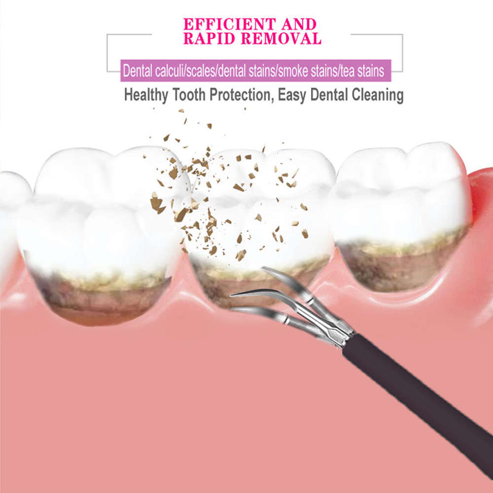 Household Electric Tooth Cleaner Calculus Remover Dental Care Tool-Black