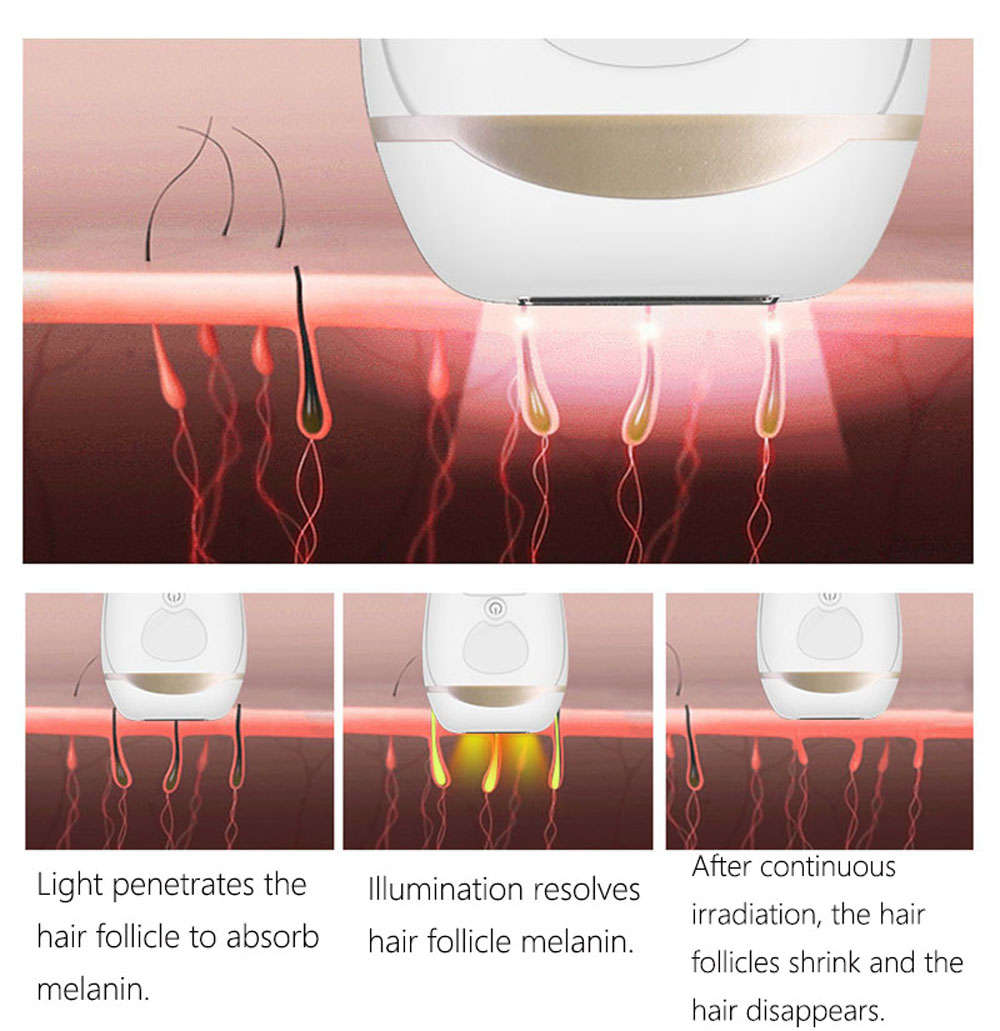 Professional Permanent IPL Epilator Laser Hair Removal Machine