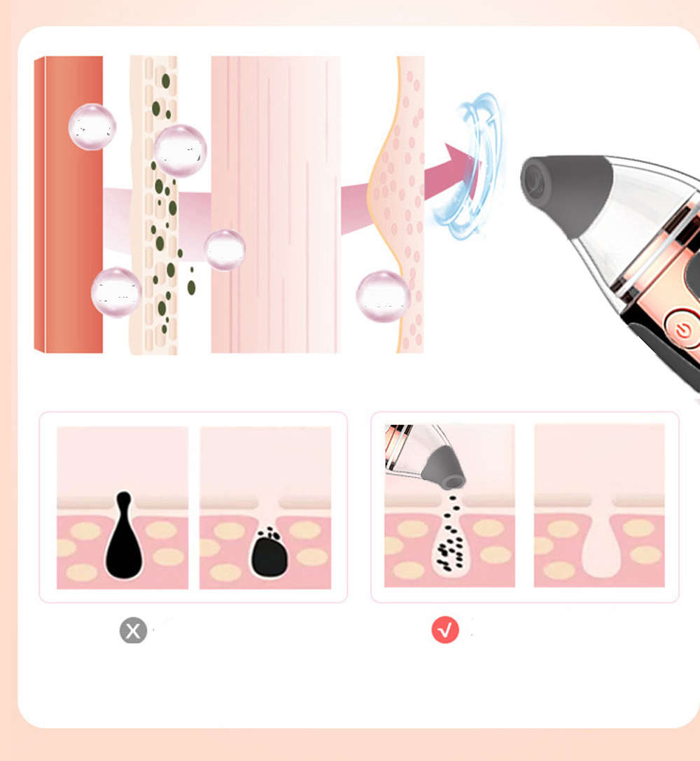 Rechargeable Blackhead Remover Vacuum Electric Facial Pore Cleaner