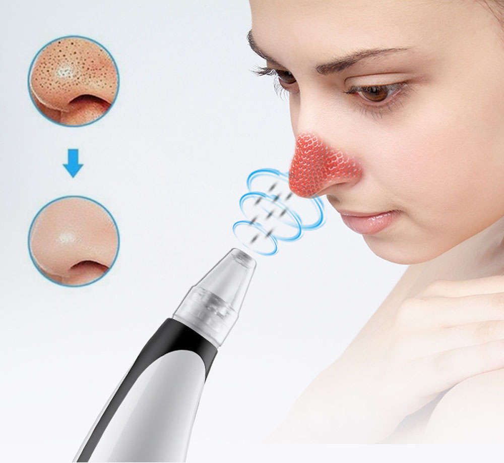 LED light blackhead remover pore vacuum cleaner with hot compress - black