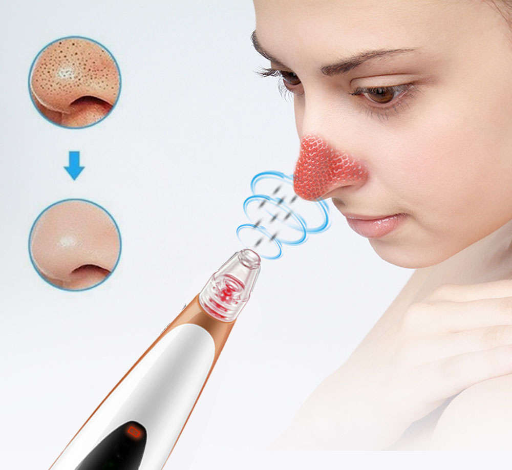 LED Light Blackhead Remover