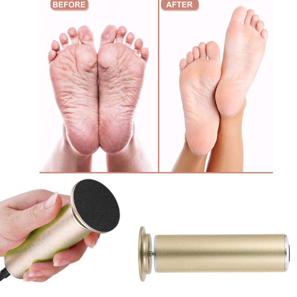 Electric Callus Remover Foot File Hard Dead skin Polisher