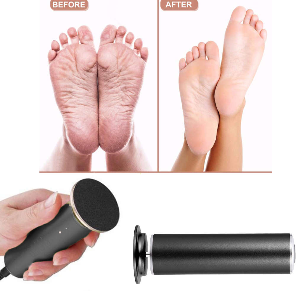 Electric Callus Remover Foot File Hard Dead skin Polisher