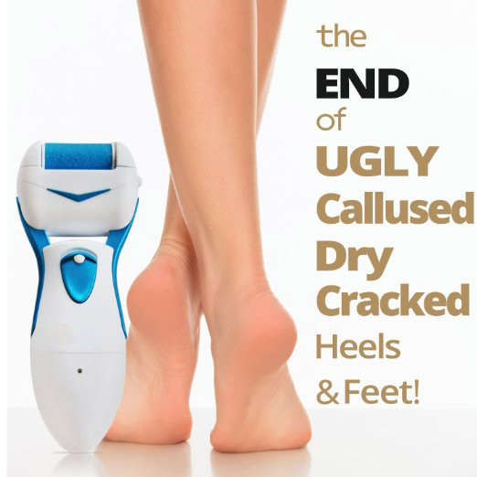 Electric Callus Remover Rechargeable Micro Pedi Foot File Shaves Dead Hard Cracked Skin on Feet