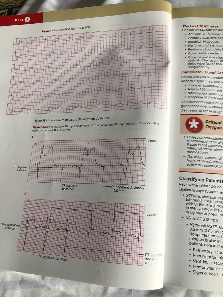ACLS Advance Cardiovascular  Life Support Provider Manual American Heart Association