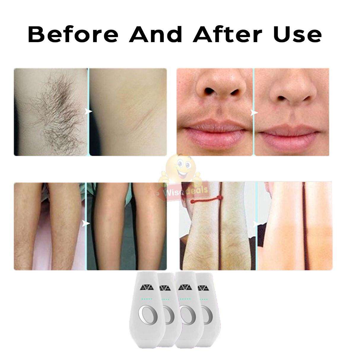 Professional LCD Display 600000 Flashes IPL Laser Hair Remover