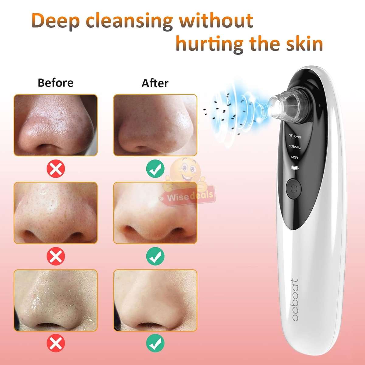 10 X Magnification HD Camera and LED lights Blackhead remover