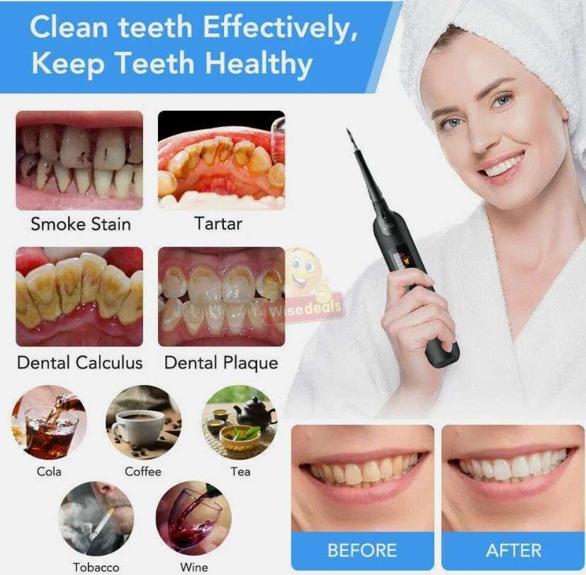 High-Speed Acoustic Vibration Electric Toothbrush and Grinding Heads