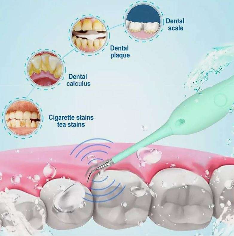 6-in-1 Electric Toothbrush and Calculus Remover Dental Care Tool Set in Blue