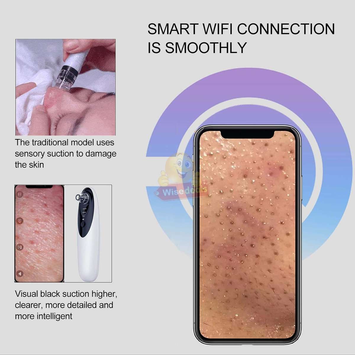 10 X Magnification HD Camera and LED lights Blackhead remover