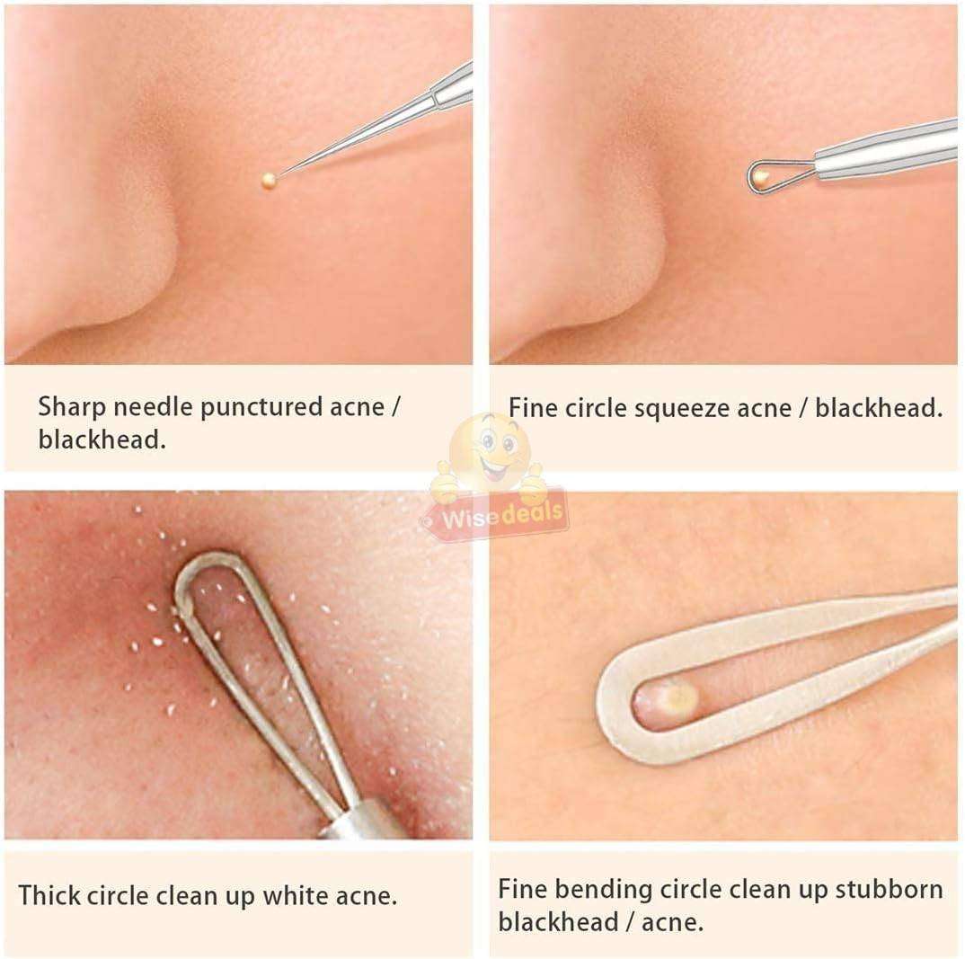5 Piece Acne Blackhead Remover Kit