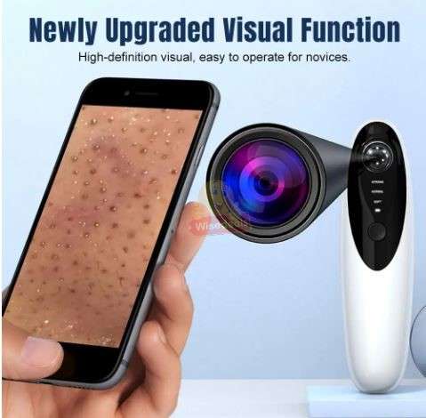10 X Magnification HD Camera and LED lights Blackhead remover