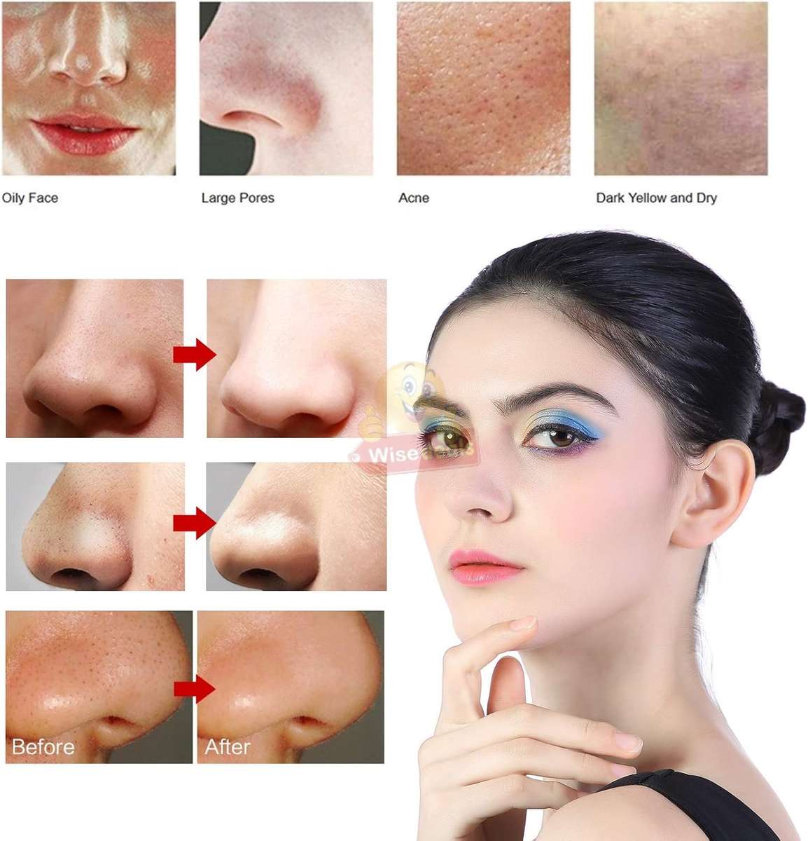 10 X Magnification HD Camera and LED lights Blackhead remover