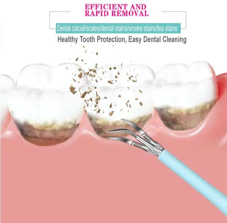 6-in-1 Electric Toothbrush and Calculus Remover Dental Care Tool Set in Blue