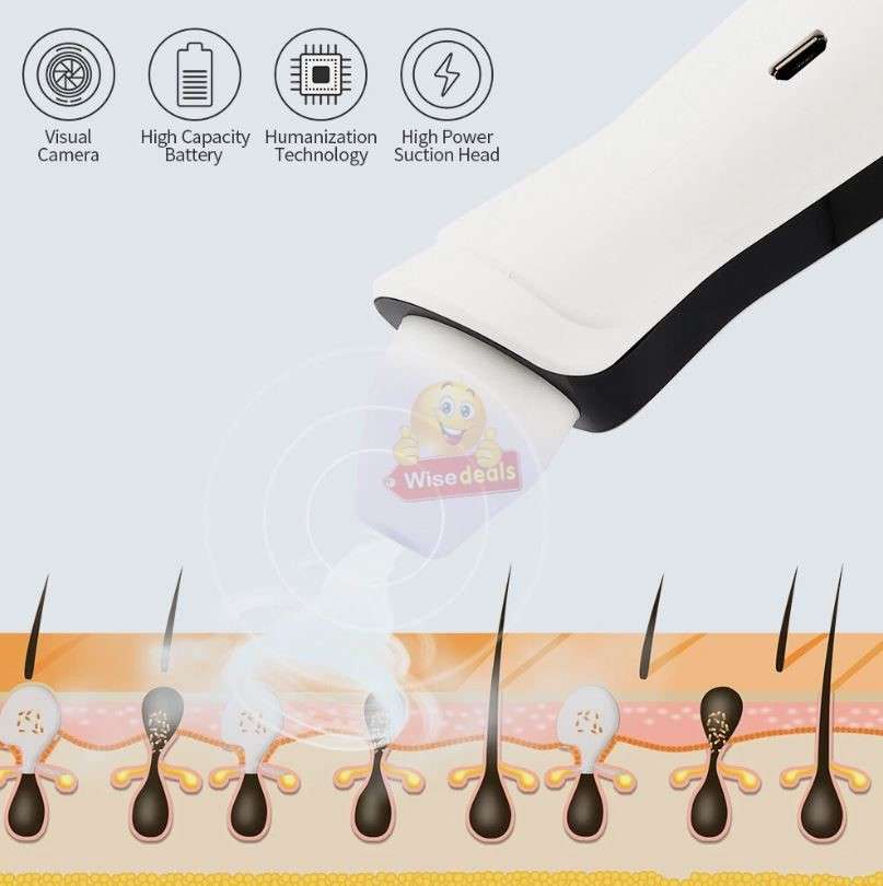 Enlarge by Camera 500X times WIFI Blackhead Remover
