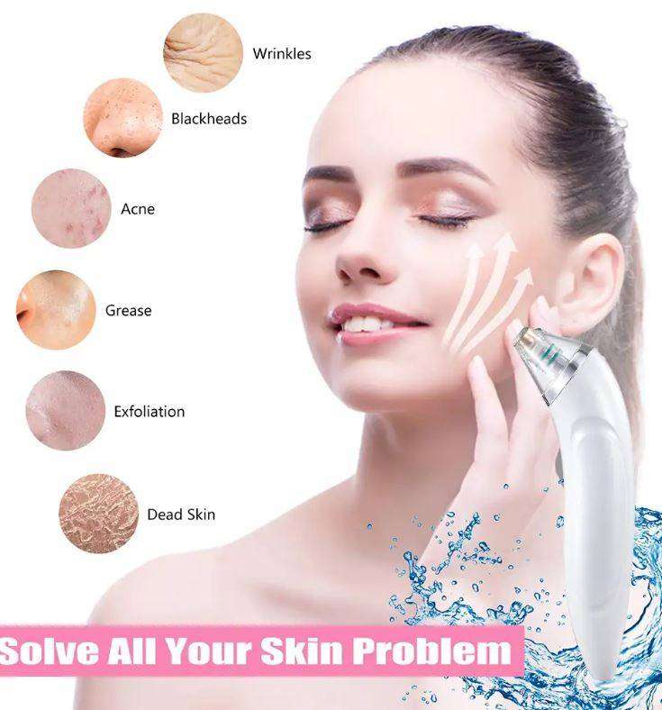 3 Levels Electronic Blackhead Remover Vacuum Cleaner with 4 Probe-White