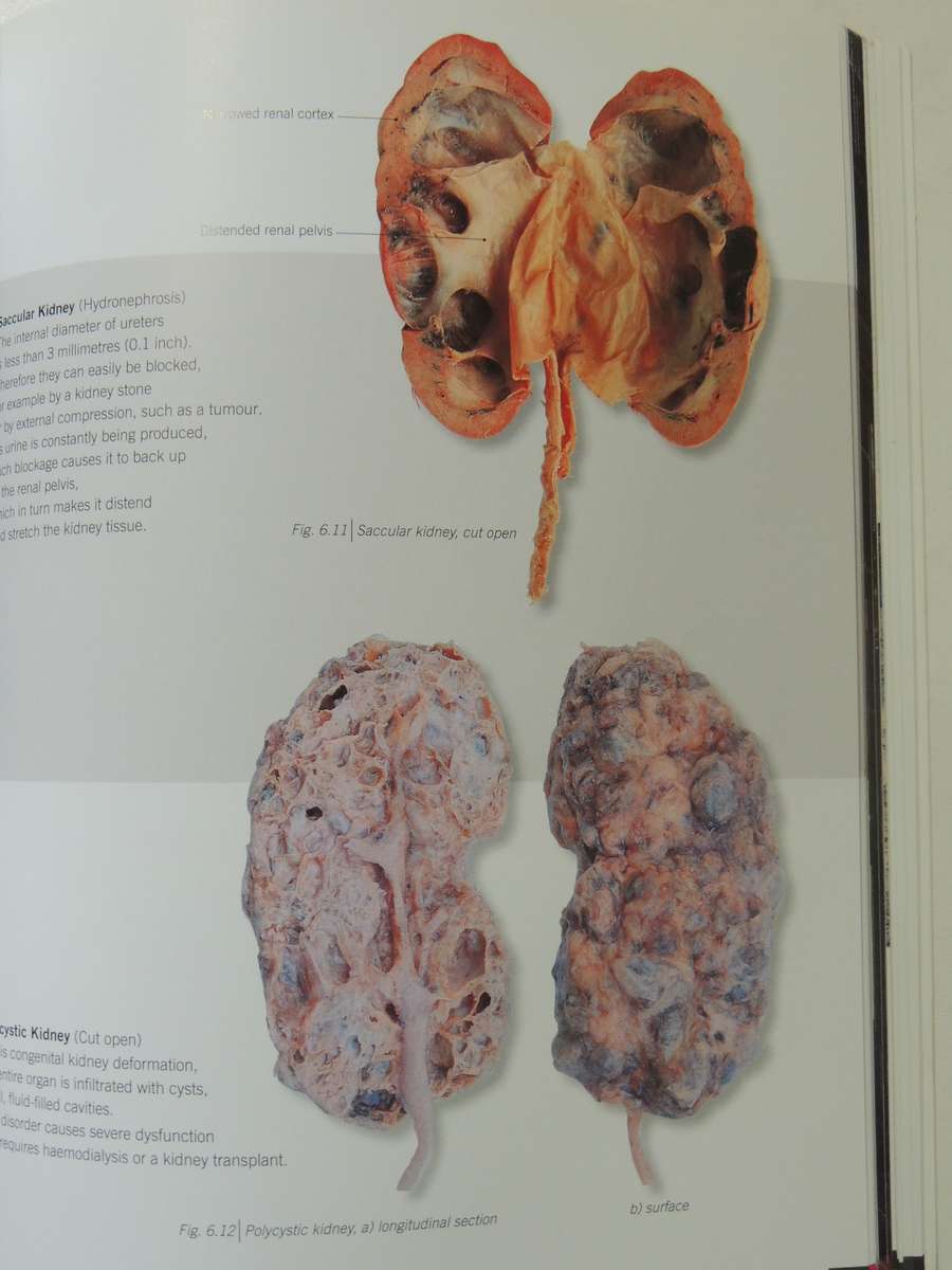 Body Worlds: The Original Exhibition - Gunther Von Hagen