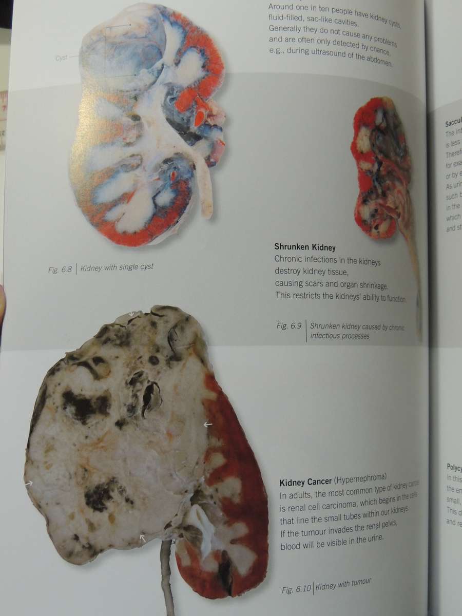 Body Worlds: The Original Exhibition - Gunther Von Hagen