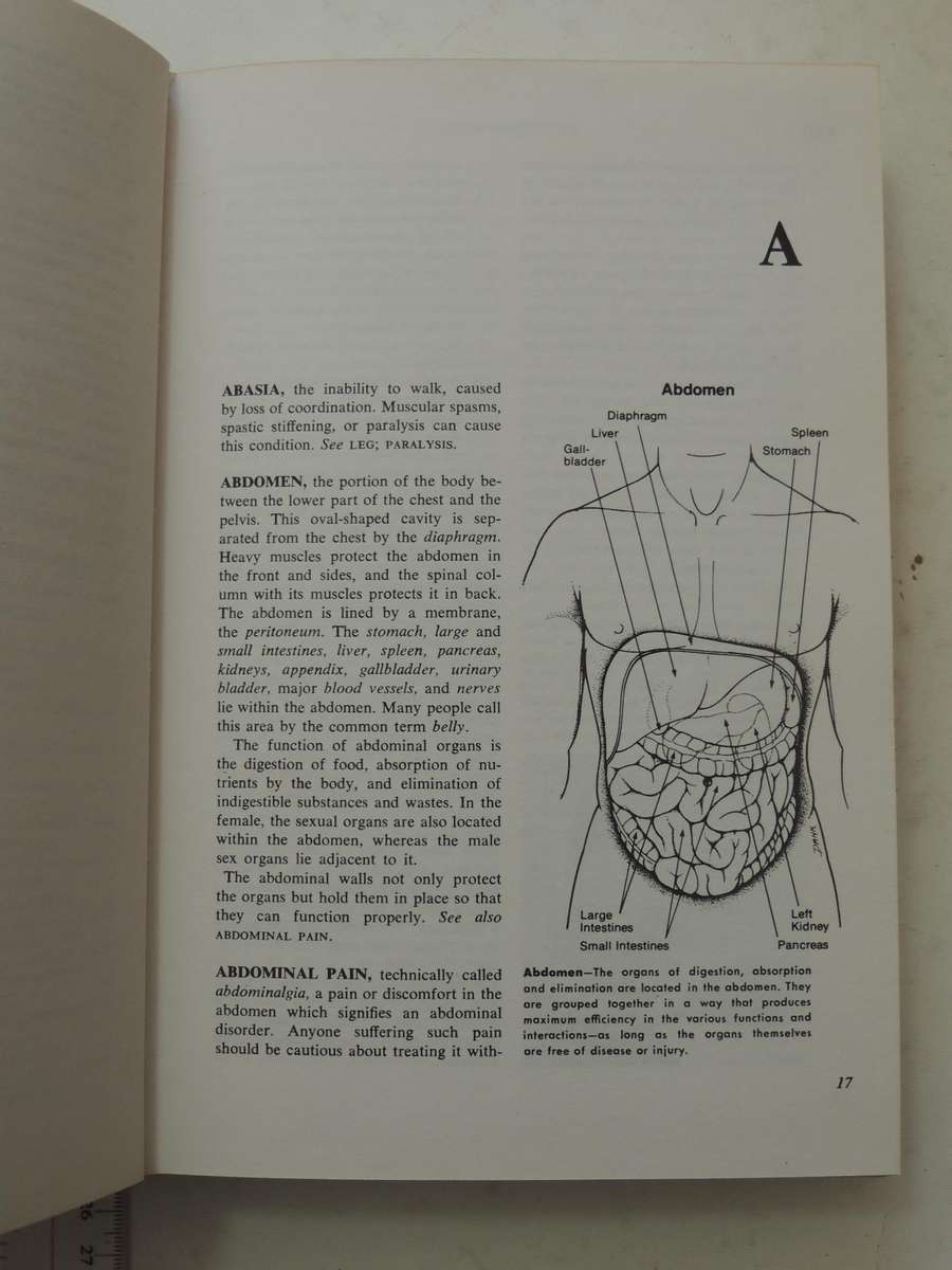 Fishbein's Medical and Health Encyclopedia  4 Volume Set, 1977