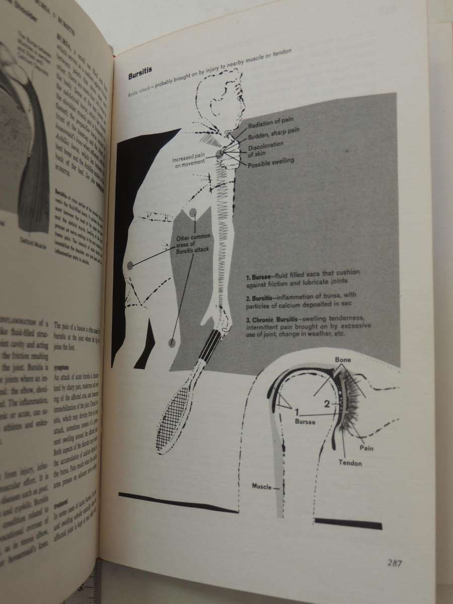 Fishbein's Medical and Health Encyclopedia  4 Volume Set, 1977
