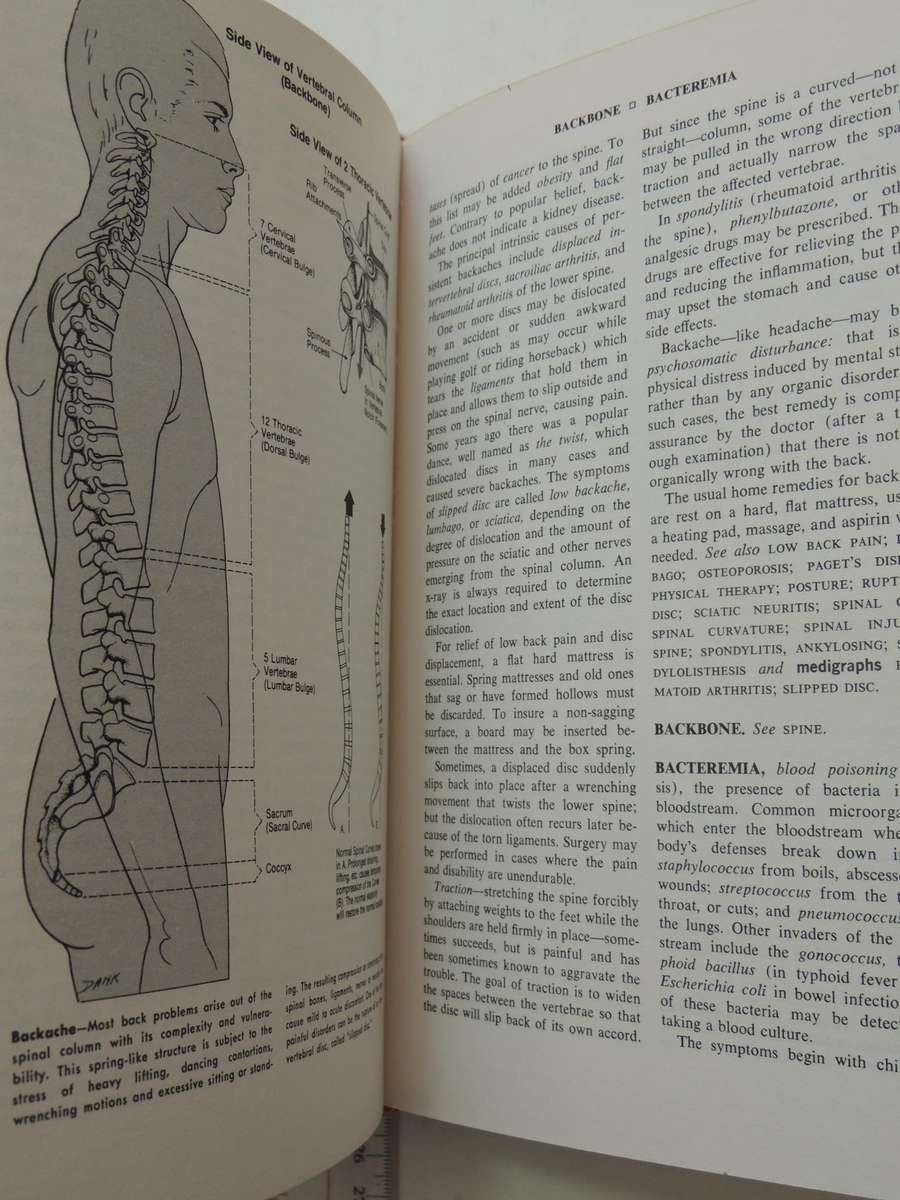 Fishbein's Medical and Health Encyclopedia  4 Volume Set, 1977