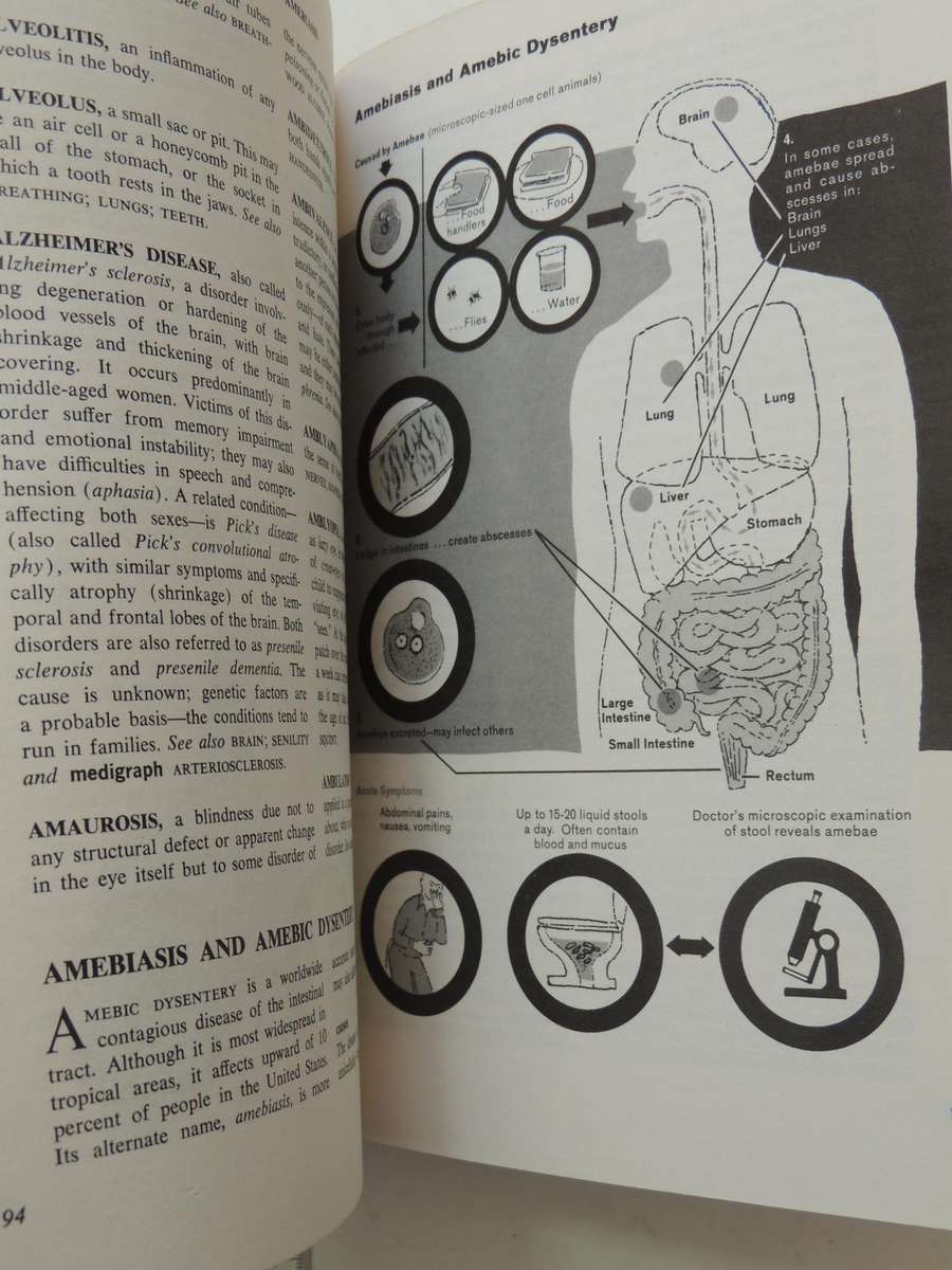 Fishbein's Medical and Health Encyclopedia  4 Volume Set, 1977