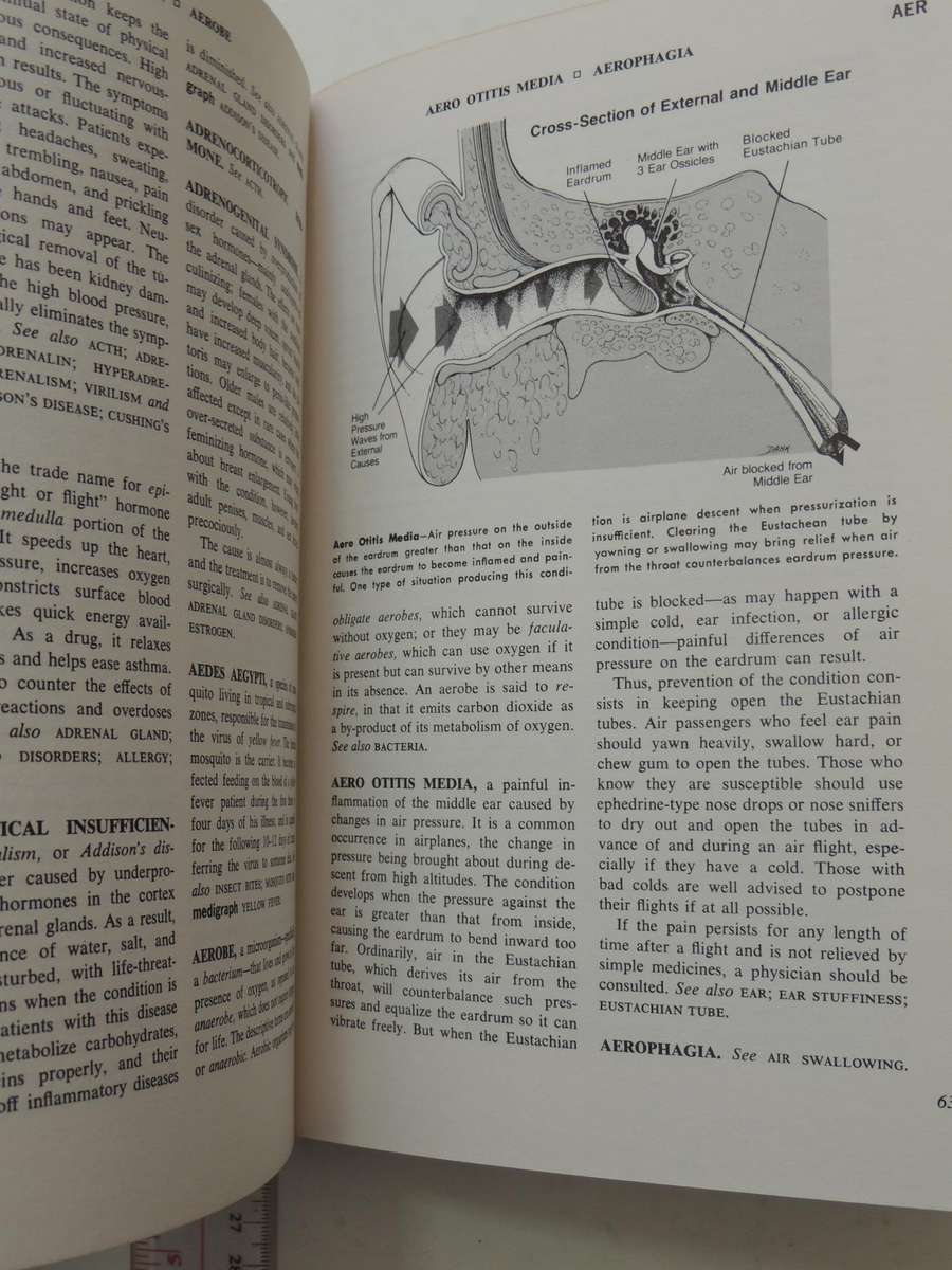 Fishbein's Medical and Health Encyclopedia  4 Volume Set, 1977