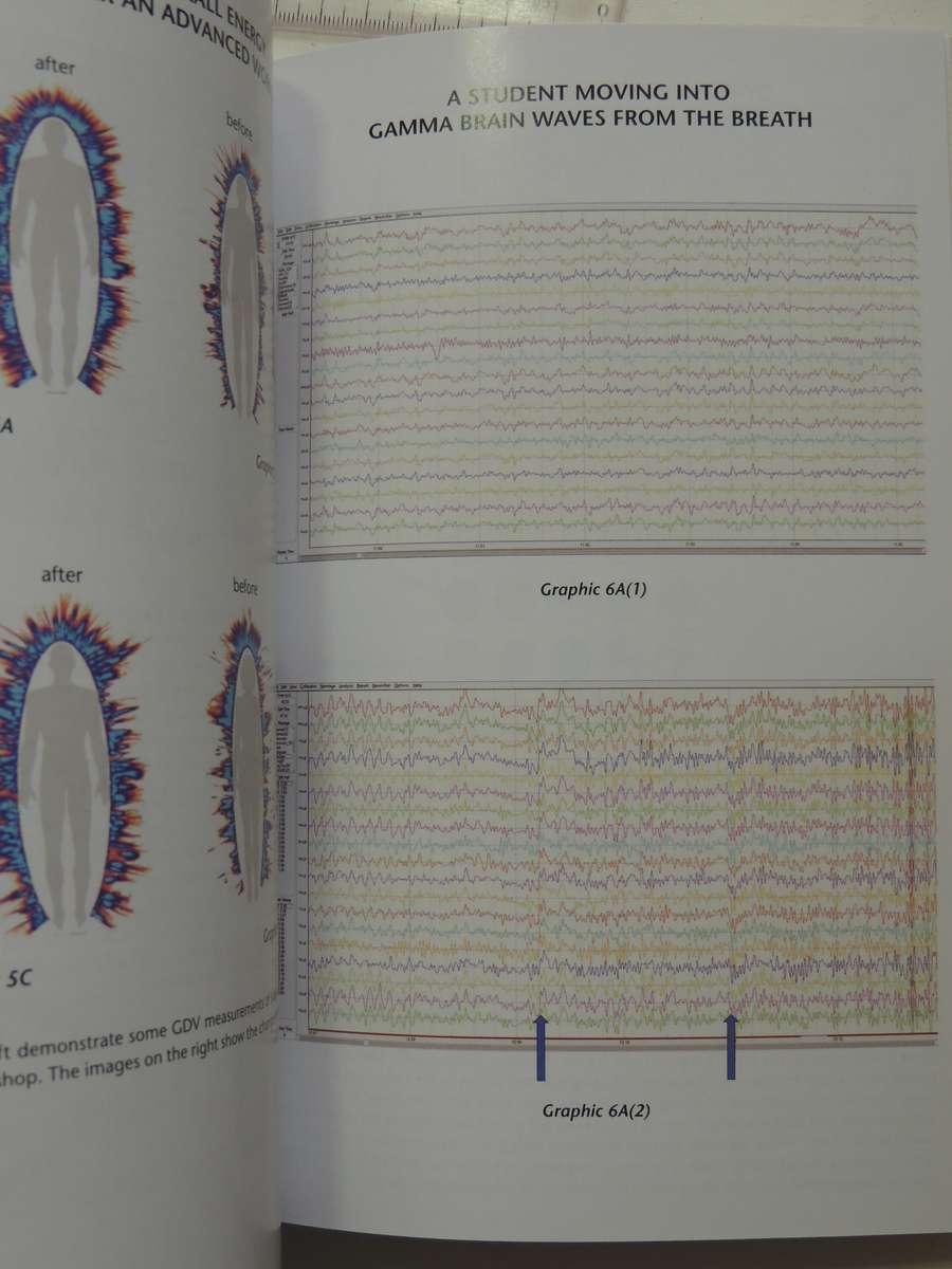 Becoming Supernatural - How Common People Are Doing the Uncommon- Joe Dispenza